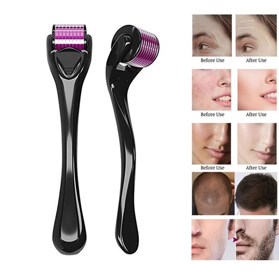 FEG Hair Growth Spray + Derma Roller Kit